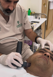 Morpheus8 non-surgical skin rejuvenation